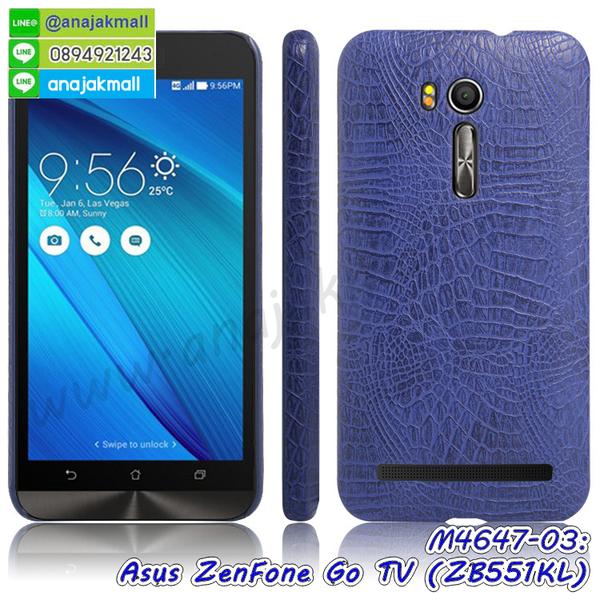 เคส ASUS ZenFone Go zb551kl,รับทำเคสเอซุส ZenFone Go zb551kl,เคสยางใส ASUS ZenFone Go zb551kl,รับพิมพ์ลายเคส ASUS ZenFone Go zb551kl,เคสโรบอท ASUS ZenFone Go zb551kl,เคส 2 ชั้น ASUS ZenFone Go zb551kl,รับสกรีนเคส ASUS ZenFone Go zb551kl,เคสปิดหน้าเอซุส ZenFone Go zb551kl,เคสกรอบหลัง ZenFone Go zb551kl,เคสหนังฝาพับ ASUS ZenFone Go zb551kl,รับทำเคสลายการ์ตูน ASUS ZenFone Go zb551kl,เคสมิเนียมหลังกระจก ZenFone Go zb551kl,ฝาหลังกันกระแทก ASUS ZenFone Go zb551kl,เคสสมุด ZenFone Go zb551kl,เคสฝาพับกระจกเอซุส ZenFone Go zb551kl,ขอบอลูมิเนียม ASUS ZenFone Go zb551kl,เคสฝาพับ ASUS ZenFone Go zb551kl,กรอบโชว์เบอร์ ZenFone Go zb551kl,เคสหนังสกรีนการ์ตูนเอซุส ZenFone Go zb551kl,เคสกันกระแทก ASUS ZenFone Go zb551kl,เคสพิมพ์ลาย ASUS ZenFone Go zb551kl,เคสแข็งพิมพ์ลาย ASUS ZenFone Go zb551kl,เคสสกรีนลายโดเรมอน ZenFone Go zb551kl,เคสลายวันพีช ZenFone Go zb551kl,เคสกันกระแทก ASUS ZenFone go zb551kl,เคสทูโทน ASUS ZenFone Go zb551kl,เคสสกรีน ZenFone Go zb551kl,เคสลายการ์ตูน 3 มิติ ZenFone Go zb551kl,เคสอลูมิเนียมกระจกเอซุส ZenFone Go zb551kl,เคสเปิดปิดสกรีนการ์ตูนเอซุส ZenFone Go zb551kl,เคสพิมพ์ลาย ASUS ZenFone Go zb551kl,เคสบัมเปอร์ ZenFone Go zb551kl,เคสคริสตัล zenfone zb551kl,เคสสกรีน ASUS ZenFone Go zb551kl,เคสกันกระแทกโรบอท ASUS ZenFone Go zb551kl,เคสยางติดแหวนคริสตัล zenfone zb551kl,กรอบแข็งดำการ์ตูน zenfone zb551kl,กรอบกันกระแทก zenfone zb551kl,สกรีนการ์ตูน zenfone zb551kl,กรอบดำ zenfone zb551kl,เคสอลูมิเนียมเอซุส ZenFone Go zb551kl,เคสยางกรอบแข็ง ASUS ZenFone Go zb551kl,ขอบโลหะ ZenFone Go zb551kl,เคสหูกระต่าย ZenFone Go zb551kl,เคสสายสะพาย ZenFone Go zb551kl,เคสประดับเอซุส ZenFone Go zb551kl,เคสยางการ์ตูน ASUS ZenFone Go zb551kl,กรอบโลหะขอบอลูมิเนียมเอซุส ZenFone Go zb551kl,กรอบอลูมิเนียม ZenFone Go zb551kl