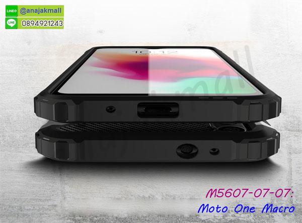 เคสประกบหน้าหลังสีแดง moto one macro,เคสยางนิ่มพิมพ์ลาย moto one macro,กรอบฝาพับ moto one macro ไดอารี่,moto one macro หนังฝาพับใส่บัตร,เคสสกรีนคู่ moto one macro,มิเนียม moto one macro กระจกเงา,กรอบยางติดแหวนคริสตัล moto one macro,เคสกรอบอลูมิเนียมลายการ์ตูน moto one macro,เกราะ moto one macro กันกระแทก,เกราะมือถือmoto one macro ลายการ์ตูน,ซิลิโคน moto one macro การ์ตูน,กรอบนิ่ม moto one macro,เคสลายทีมฟุตบอล moto one macro,เคสประกบ moto one macro,ฝาหลังกันกระแทก moto one macro,เคสปิดหน้า moto one macro,โชว์หน้าจอ moto one macro,หนังลายวันพีช moto one macro,moto one macro ฝาพับสกรีนลูฟี่,เคสฝาพับ moto one macro โชว์เบอร์,เคสเพชร moto one macro คริสตัล,กรอบแต่งคริสตัล moto one macro,เคสยางนิ่มลายการ์ตูนmoto one macro