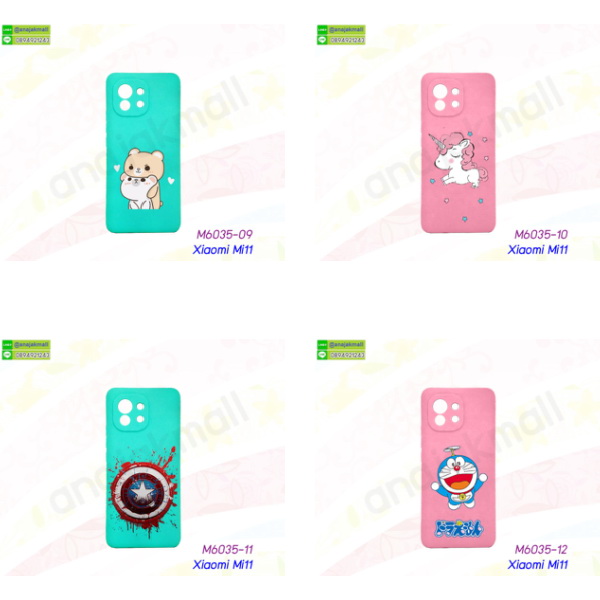 เคส xiaomi mi11 ลายการ์ตูน,กรอบหนัง xiaomi mi11 ไดอารี่ใส่บัตร,xiaomi mi11 เคสพร้อมส่ง,xiaomi mi11 เคสหนังฝาพับ,รับสกรีนเคส xiaomi mi11,เคส xiaomi mi11 กันกระแทกยาง,เคส xiaomi mi11 กันกระแทกลายการ์ตูน,เคสพิมพ์ลาย xiaomi mi11,เคสมือถือ xiaomi mi11,กรอบกันกระแทก xiaomi mi11,เคสหนัง xiaomi mi11,เคสฝาพับแต่งคริสตัล xiaomi mi11,เคสโรบอท xiaomi mi11,xiaomi mi11 เคสกันกระแทกไฮบริด,xiaomi mi11 เคสฝาพับใส่บัตร,เคสกันกระแทก xiaomi mi11,เคสฝาพับ xiaomi mi11,เคสโชว์เบอร์ xiaomi mi11,เคสโชว์หน้าจอ xiaomi mi11,เคสอลูมิเนียม xiaomi mi11