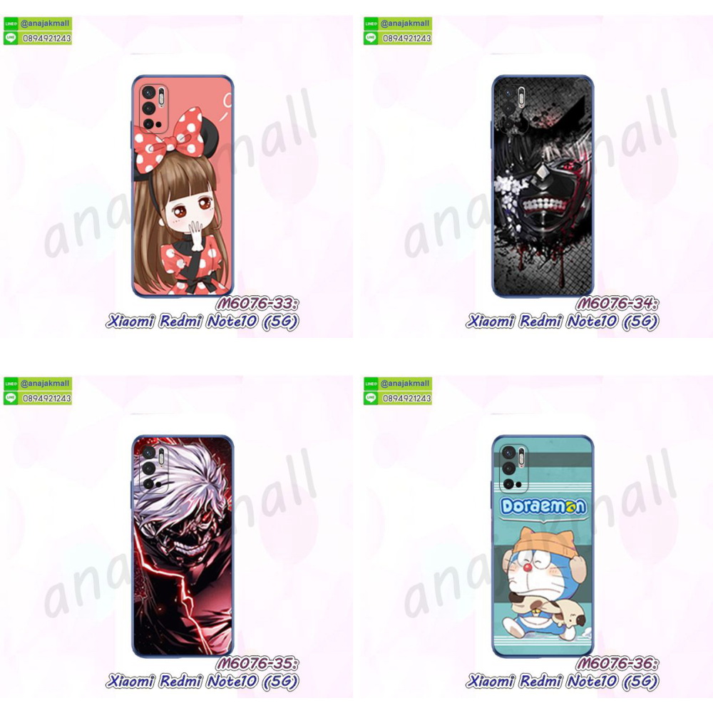 เคส xiaomi redmi note10 5g ระบายความร้อน,กรอบหนัง xiaomi redmi note10 5g ไดอารี่ใส่บัตร,xiaomi redmi note10 5g เคสพร้อมส่ง,xiaomi redmi note10 5g เคสหนังฝาพับ,รับสกรีนเคส xiaomi redmi note10 5g,เคส xiaomi redmi note10 5g กันกระแทกยาง,เคส xiaomi redmi note10 5g กันกระแทกลายการ์ตูน,เคสพิมพ์ลาย xiaomi redmi note10 5g,เคสมือถือ xiaomi redmi note10 5g,กรอบกันกระแทก xiaomi redmi note10 5g,เคสหนัง xiaomi redmi note10 5g,เคสฝาพับแต่งคริสตัล xiaomi redmi note10 5g,เคสโรบอท xiaomi redmi note10 5g,xiaomi redmi note10 5g เคสกันกระแทกไฮบริด,xiaomi redmi note10 5g เคสฝาพับใส่บัตร,เคสกันกระแทก xiaomi redmi note10 5g,เคสฝาพับ xiaomi redmi note10 5g