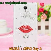 M1812-09 เคสประดับ OPPO Joy 3 ลาย Love Kiss