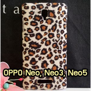 M1135-01 เคสแข็งบุผ้าขนสัตว์ OPPO Neo3/Neo5 ลายเสือดาว