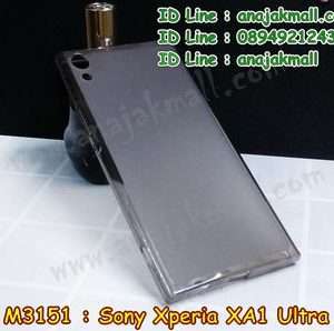 M3151-01 เคสยาง Sony Xperia XA1 Ultra สีดำ
