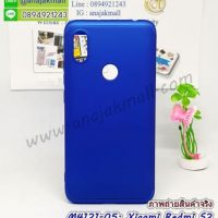 M4124-05 เคสประกบหัวท้ายไฮคลาส Xiaomi Redmi S2 สีน้ำเงิน