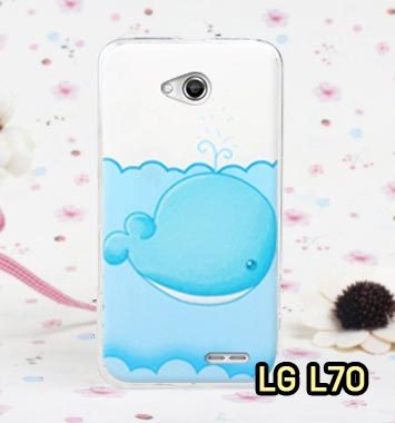 M803-01 เคสแข็ง LG L70 ลายปลาวาฬ