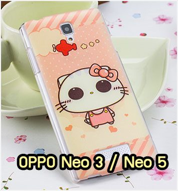 M870-35 เคสแข็ง OPPO Neo 3 / Neo 5 ลาย Cucat II