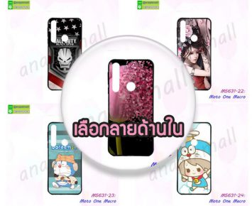 M5631 เคส Moto One Macro พิมพ์ลายการ์ตูน (เลือกลาย)